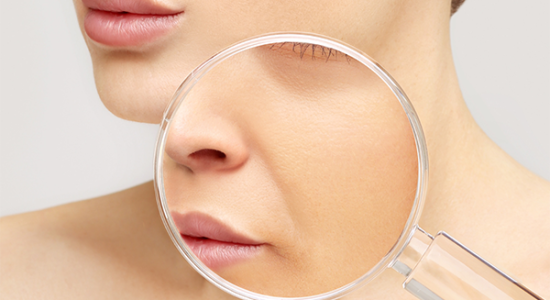 Ácido Hialurónico Ácido Hialurónico