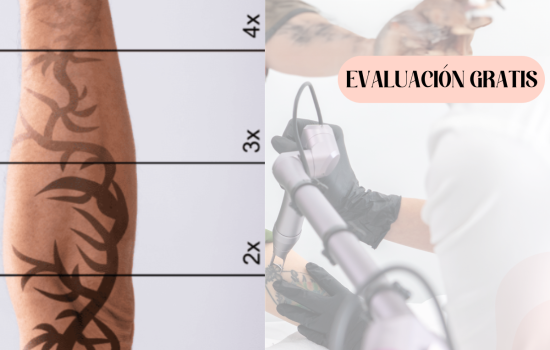 Láser Q-Switched ND Yag